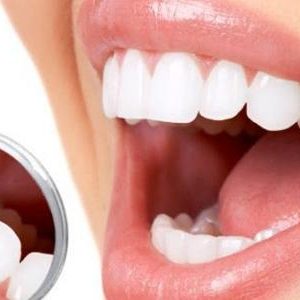 العناية بالاسنان